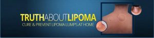 lipoma removal